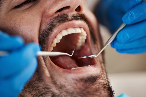 Dentist for Dental Trauma in NJ